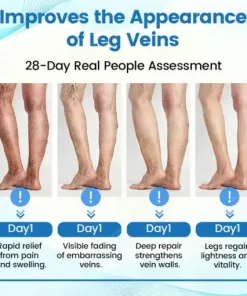 VascuCare Vein Healing Spray