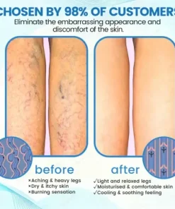 VascuCare Vein Healing Spray