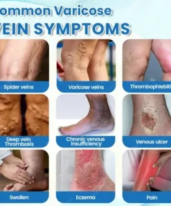 VascuCare Vein Healing Spray