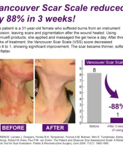 cure FACE & BODY SCAR GEL