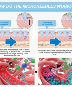 𝐒limming & 𝐻ealth 𝑁ano 𝑀icroneedle 𝑃atch