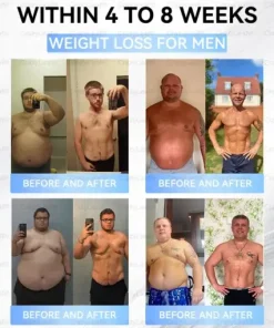 𝐒limming & 𝐻ealth 𝑁ano 𝑀icroneedle 𝑃atch