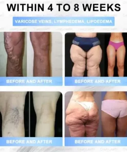 𝐒limming & 𝐻ealth 𝑁ano 𝑀icroneedle 𝑃atch