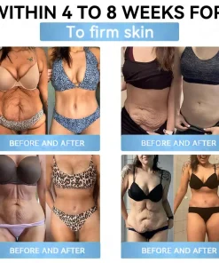 𝐑𝐨𝐩𝐜𝐞𝐞𝐫® 𝐆𝐋𝐏-𝟏 𝐏𝐫𝐨 𝐌𝐞𝐭𝐚𝐛𝐨𝐥𝐢𝐜 𝐑𝐞𝐠𝐮𝐥𝐚𝐭𝐢𝐨𝐧 𝐎𝐫𝐚𝐥 𝐒𝐩𝐫𝐚𝐲