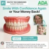 SEAGRIL™ Custom-Fit Full Functional Dentures