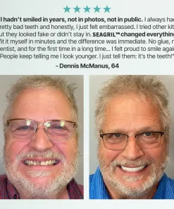 SEAGRIL™ Custom-Fit Full Functional Dentures