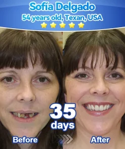 𝑃𝑖𝑐𝑑𝑜® 𝑆𝑡𝑒𝑚 𝐶𝑒𝑙𝑙 𝐺𝑖𝑛𝑔𝑖𝑣𝑎𝑙 𝑅𝑒𝑝𝑎𝑖𝑟 𝑀𝑜𝑢𝑠𝑠𝑒