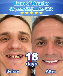 𝑃𝑖𝑐𝑑𝑜® 𝑆𝑡𝑒𝑚 𝐶𝑒𝑙𝑙 𝐺𝑖𝑛𝑔𝑖𝑣𝑎𝑙 𝑅𝑒𝑝𝑎𝑖𝑟 𝑀𝑜𝑢𝑠𝑠𝑒