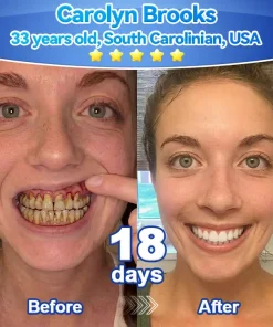 𝑃𝑖𝑐𝑑𝑜® 𝑆𝑡𝑒𝑚 𝐶𝑒𝑙𝑙 𝐺𝑖𝑛𝑔𝑖𝑣𝑎𝑙 𝑅𝑒𝑝𝑎𝑖𝑟 𝑀𝑜𝑢𝑠𝑠𝑒