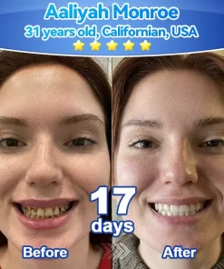 𝑃𝑖𝑐𝑑𝑜® 𝑆𝑡𝑒𝑚 𝐶𝑒𝑙𝑙 𝐺𝑖𝑛𝑔𝑖𝑣𝑎𝑙 𝑅𝑒𝑝𝑎𝑖𝑟 𝑀𝑜𝑢𝑠𝑠𝑒