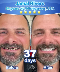 𝑃𝑖𝑐𝑑𝑜® 𝑆𝑡𝑒𝑚 𝐶𝑒𝑙𝑙 𝐺𝑖𝑛𝑔𝑖𝑣𝑎𝑙 𝑅𝑒𝑝𝑎𝑖𝑟 𝑀𝑜𝑢𝑠𝑠𝑒