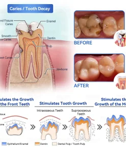 𝑃𝑖𝑐𝑑𝑜® 𝑆𝑡𝑒𝑚 𝐶𝑒𝑙𝑙 𝐺𝑖𝑛𝑔𝑖𝑣𝑎𝑙 𝑅𝑒𝑝𝑎𝑖𝑟 𝑀𝑜𝑢𝑠𝑠𝑒