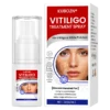 Vitiligo Repigmentation Spray