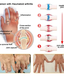 Labolab® BPC-157 + Turmeric & Emu Oil Meniscus Pain Relief Spray