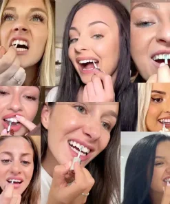 Misspone™ Tooth Polish - Instant Clean Smile