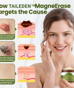 MagneErase Renewal Cream