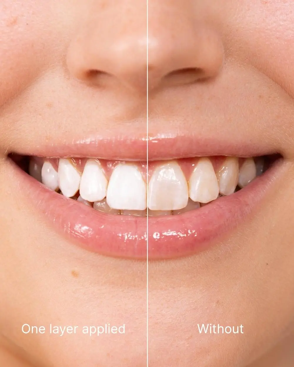 Teeth Polish - Instant White Teeth - Image 3