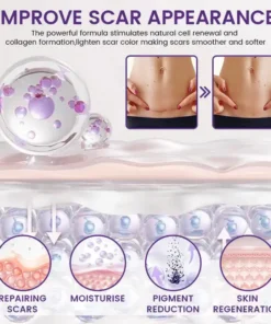 Alisanda® ReGenScar Rapid Recovery Scar Gel