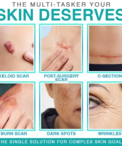 BBOJI® 3-in-1 Microneedle Care Patch