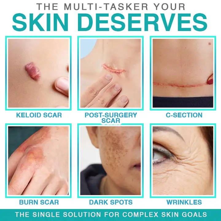 BBOJI® 3-in-1 Microneedle Care Patch