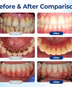 Biancat® BeeTakt Oral Repair Solution