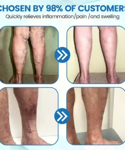 COUGEX® VascuCare Vein Healing Spray