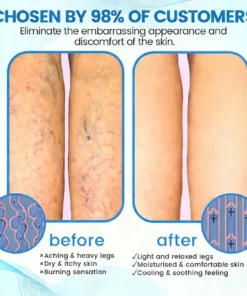 COUGEX® VascuCare Vein Healing Spray