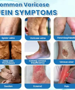 COUGEX® VascuCare Vein Healing Spray