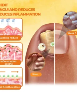 Cvreoz® Bee Venom Nail Renewal Spray