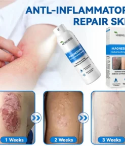 HOBENSUN® Magnesium Herbal Psoriasis Spray