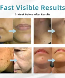 Howcode™ All-in-One CO₂ Laser Eraser Pen