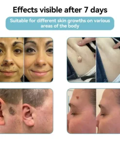 Howcode™ All-in-One CO₂ Laser Eraser Pen