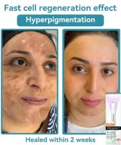 Howcode™ All-in-One CO₂ Laser Eraser Pen