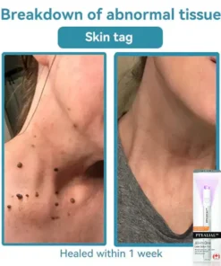 Howcode™ All-in-One CO₂ Laser Eraser Pen