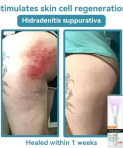 Howcode™ All-in-One CO₂ Laser Eraser Pen