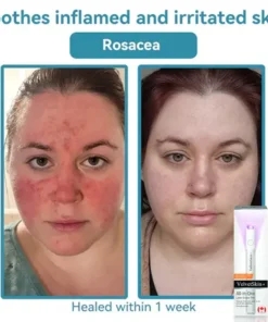 Oceahade™ All-in-One CO₂ Laser Eraser Pen