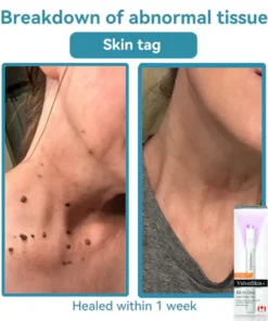 Oceahade™ All-in-One CO₂ Laser Eraser Pen