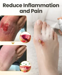 Timilk® GlucaVeil 24H Foot Barrier Spray