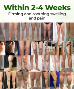 Timilk® Professional Leg Circulation Cream