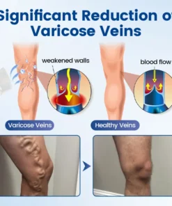 Timilk® Vein Ease Microneedle Therapy Patch