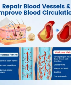 Timilk® Vein Ease Microneedle Therapy Patch