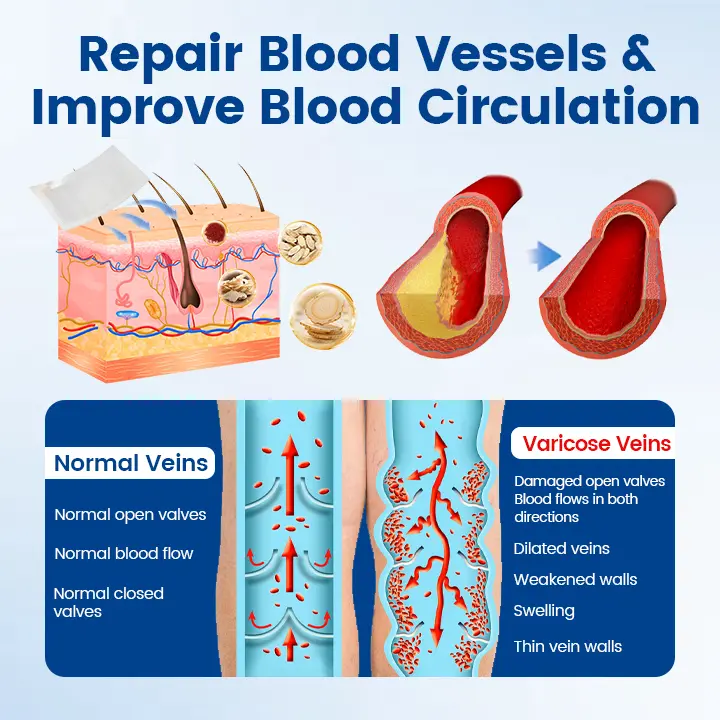 Timilk® Vein Ease Microneedle Therapy Patch