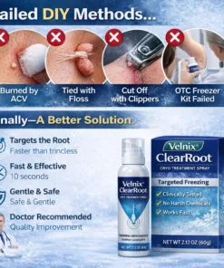 Velnix® ClearRoot Cryo Treatment Spray