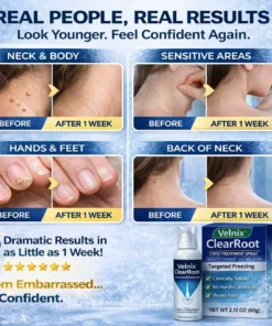 Velnix® ClearRoot Cryo Treatment Spray