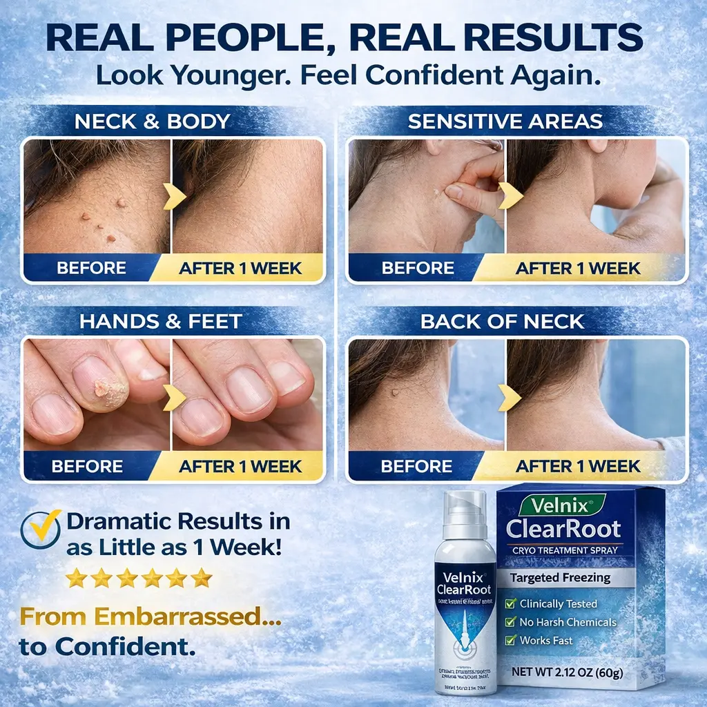 Velnix® ClearRoot Cryo Treatment Spray