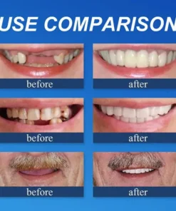 Yagoo™ Medical Full Denture with Strong Suctiond