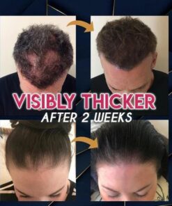 Pure Grow Hair Growth Essence