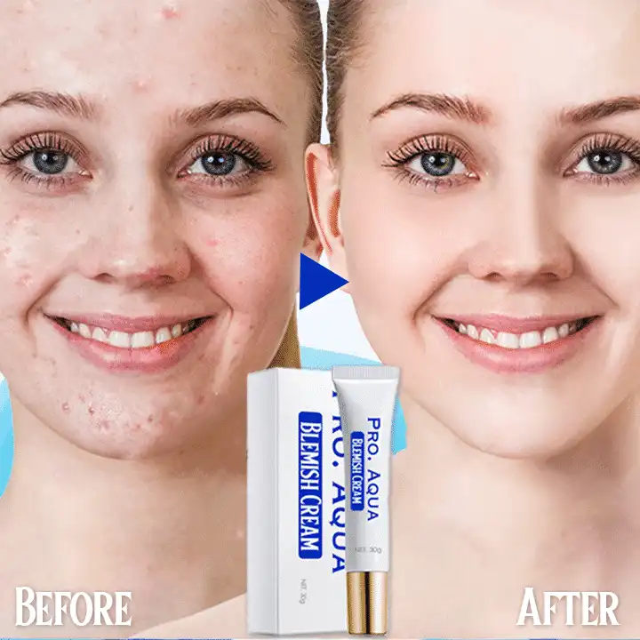 Pro Aqua Blemish Cream - Image 2