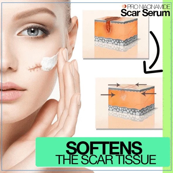 PRO Niacinamide Scar Serum - Image 2