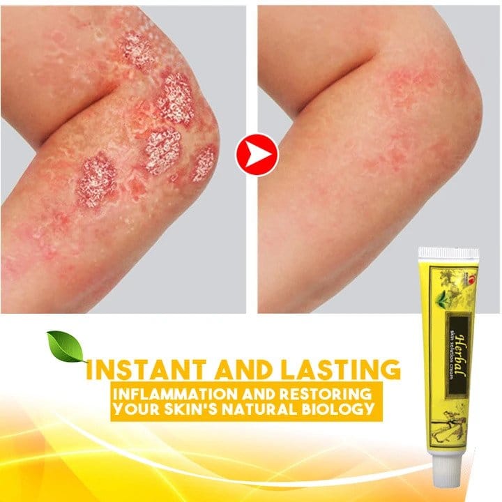 Herbal Skin Solutions Cream - Image 2